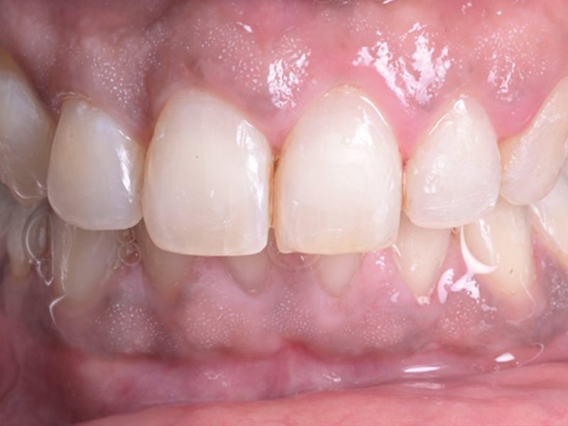 after image