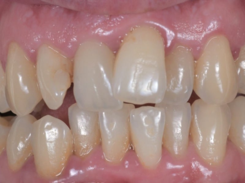 before image