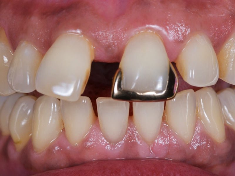 before image